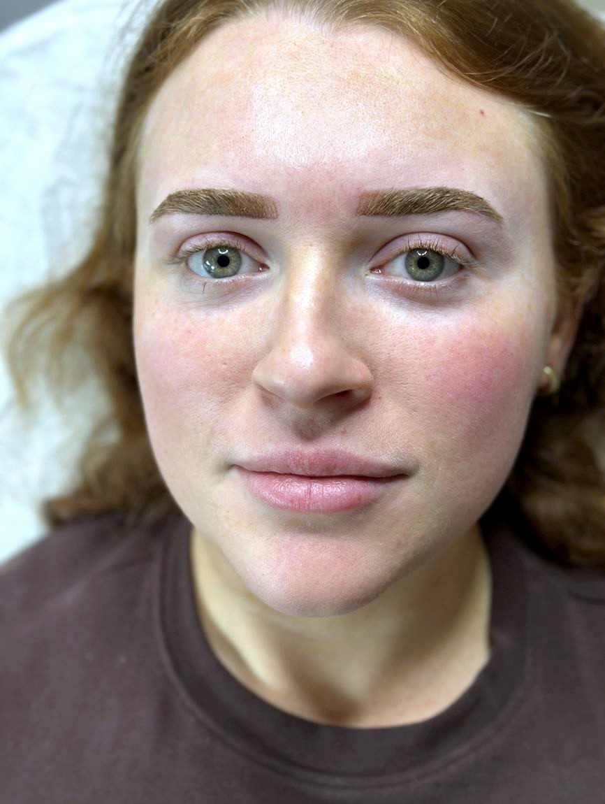 Cosmetic tattoo